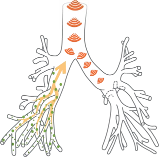 vl-mechanism-of-action-1-1920w